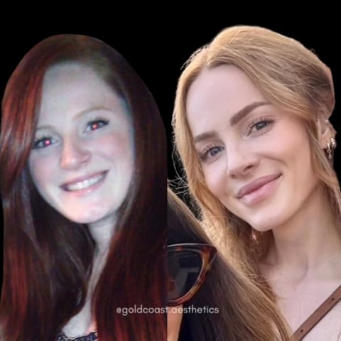 Side-by-side comparison of a woman with reddish-brown hair on left and blonde hair on right, showing before and after appearance