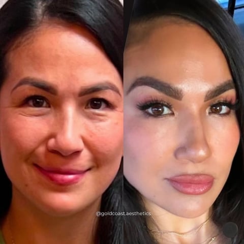 Before and after cosmetic enhancement comparison showing facial changes including skin texture, makeup application, and facial features