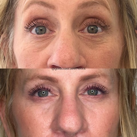 Before and after comparison of eye area showing makeup application, with enhanced eyeliner and eyeshadow on lower image