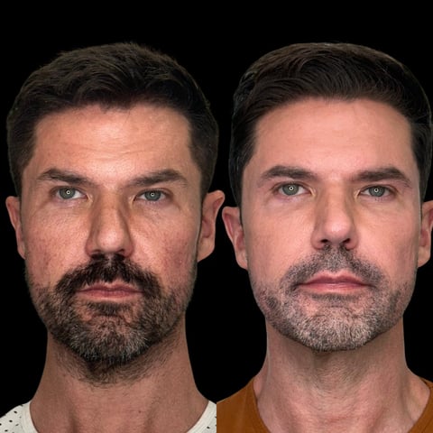 Side-by-side portrait comparison of two men with dark hair and facial hair against a black background